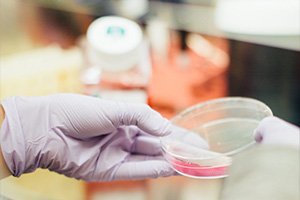 FAQ: Can I Choose Which Research Study I Want My Donation to Benefit?