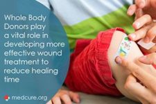 Spotlight: Improvements in Wound Treatment