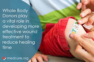 Spotlight: Improvements in Wound Treatment